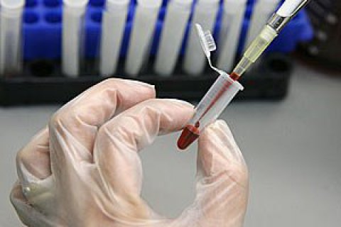 В Бердянске у отдыхающего заподозрили холеру