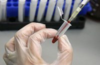 В Бердянске у отдыхающего заподозрили холеру
