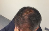 Болельщики "Фенербахче" разбили голову тренеру "Бешикташа" во время матча полуфинала Кубка Турции