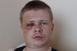 Избитый лидер "Дорожного контроля" рассказал подробности происшествия