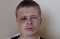 Избитый лидер "Дорожного контроля" рассказал подробности происшествия