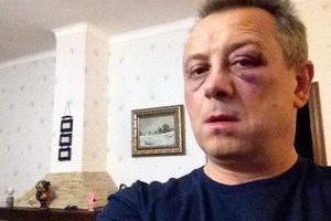 По факту избиения Куренного проводится досудебное расследование