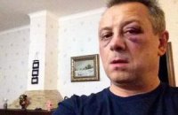 По факту избиения Куренного проводится досудебное расследование