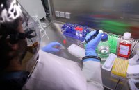 У Гані підтвердили перші випадки смертельного вірусу Марбург