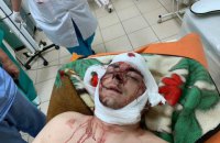 Дело об избиении экс-мэра Конотопа переквалифицировали на более жесткую статью