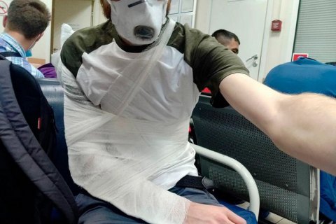 ​В России полицейский сломал руку журналисту, который освещал голосование по поправкам в Конституцию 