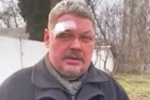 В Припутнях прихожанин УПЦ МП ударил священника ПЦУ