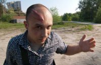 Журналиста избили телескопической трубкой