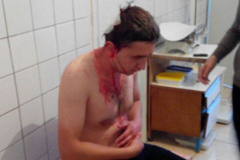 В Олевске избили журналиста, боровшегося против нелегального промысла янтаря