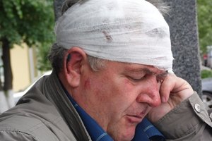 В Виннице жестоко избили правозащитника