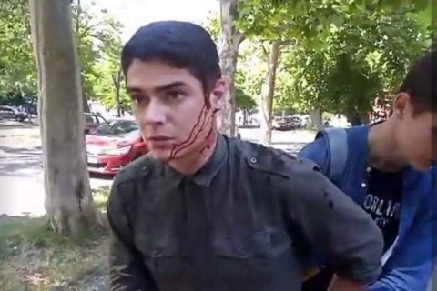 Полиция задержала двух подозреваемых в нападении на лидера одесского "Автомайдана"