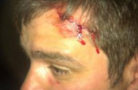 У Києві побили кандидата в депутати Київради від "Свободи"