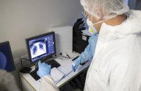 В Украине за сутки обнаружили 6 719 новых случаев ковида, 141 пациент умер