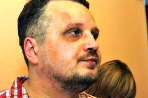 В Херсоне побитого из-за мэра журналиста сделали обвиняемым