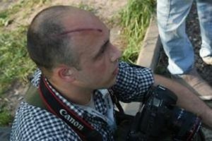 Милиция обвинила избитого журналиста в нападении на "какого-то человека"