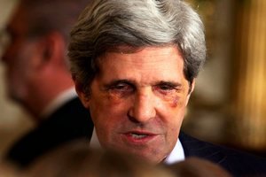 Американский сенатор пришел к Обаме со сломанным носом и синяком