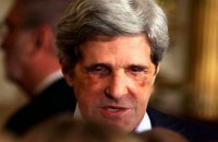 Американский сенатор пришел к Обаме со сломанным носом и синяком