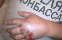 Милиция винит перфоратор в ранении мужчины в футболке "Спасибо жителям Донбасса"
