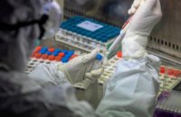  Ще 108 випадків ковіду зафіксували у ЗСУ