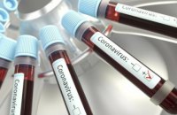 За сутки количество случаев COVID-19 в Украине возросло на 156 до 1251