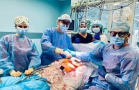 Від 800 000 грн і вище: скільки коштує пересадка органів в Україні
