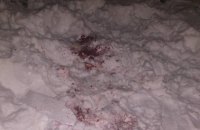 Житель Харькова лишился кисти, запуская фейерверк на Новый год