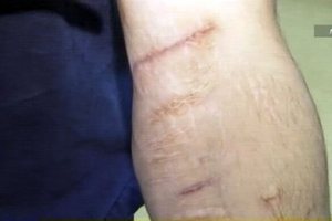 В челябинской колонии строгого режима 82 человека порезали вены
