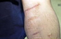 В челябинской колонии строгого режима 82 человека порезали вены