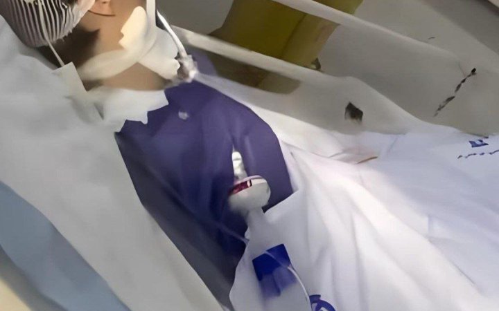 Померла іранська дівчина, яка впала в кому після можливої сутички з поліцією через хіджаб