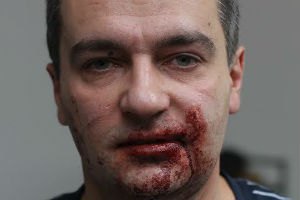 ​Милиция возле ВР: "Не ходите к "титушкам" - мы ничем не поможем" 