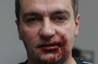 ​Милиция возле ВР: "Не ходите к "титушкам" - мы ничем не поможем" 