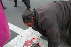 Прокуратура начала расследовать бездействие донецкой милиции при нападении на мирный митинг