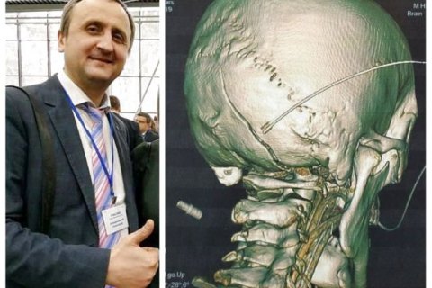 В Виннице полицейские проломили голову соратнику Гриценко