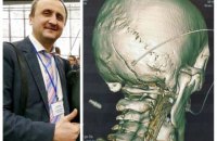В Виннице полицейские проломили голову соратнику Гриценко
