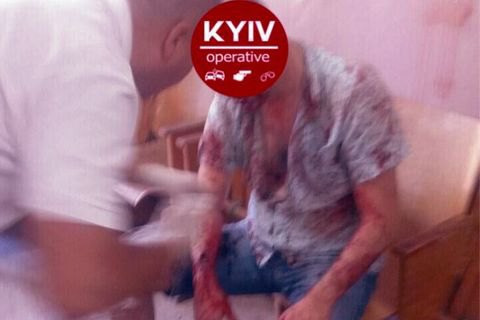 В Подольском ЖЭКе в мужчину выстрелили несколько раз и отобрали 200 тыс. гривен
