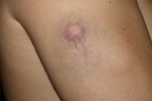 Среди стрелявших по прохожим в Кировограде оказались милиционеры 