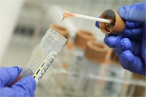В Италии начались эксперименты на людях с помощью стволовых клеток