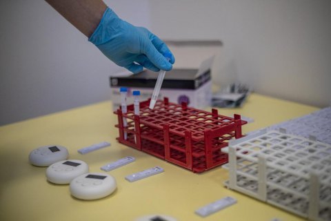 За сутки в Украине зафиксировали 6 377 новых случаев ковида