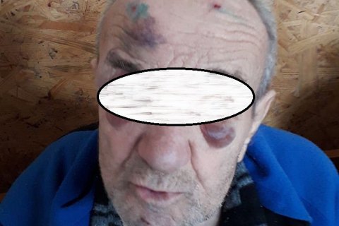 В психоневрологическом интернате Днепропетровской области жестоко издевались над подопечными 