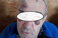 В психоневрологическом интернате Днепропетровской области жестоко издевались над подопечными 