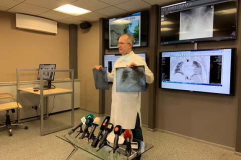 У Дніпрі помер чоловік із вірусною пневмонією, ще три людини в лікарні