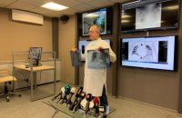 В Днепре умер мужчина с вирусной пневмонией, еще три человека в больнице