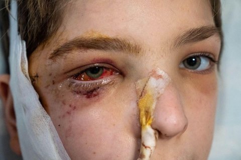 С начала войны Россия убила в Украине 103 ребенка