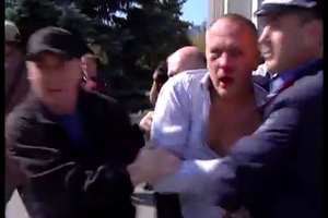 Шуфричу в Одесі розбили обличчя