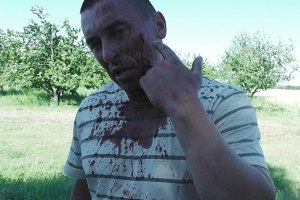 Милиция расследует драку на "Агрофирме Корнацких"