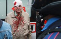 В результате нападения сепаратистов в Донецке пострадало 14 человек, - ОГА