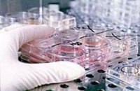 Минздрав насчитал 67 случаев калифорнийского гриппа