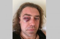 "Свободовца" Мирошниченко избил сожитель бывшей жены (обновлено)