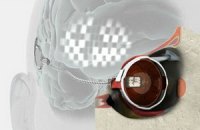 Ученые успешно испытали бионический глаз, вживленный человеку
