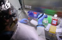 У Гвінеї кількість жертв вірусу Ебола зросла до 122 осіб